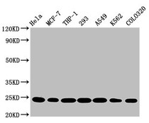 Western Blot; Positive WB detected in: Hela whole cell lysate, MCF-7 whole cell lysate, THP-1 whole cell lysate, 293 whole cell lysate, A549 whole cell lysate, K562 whole cell lysate, Colo320 whole cell lysate; All lanes: BAK1 antibody at 0.9ug/ml; Secondary; Goat polyclonal to rabbit IgG at 1/50000 dilution; Predicted band size: 24, 17 KDa; Observed band size: 24 KDa