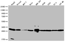 Western Blot; Positive WB detected in: HepG2 whole cell lysate, Ntera-2 whole cell lysate, MCF-7 whole cell lysate, Hela whole cell lysate, HEK293 whole cell lysate, A549 whole cell lysate, U251 whole cell lysate, PC3 whole cell lysate, U87 whole cell lysate; All lanes: BCAP31 antibody at 1:2000; Secondary; Goat polyclonal to rabbit IgG at 1/50000 dilution; Predicted band size: 28, 35 kDa; Observed band size: 28-36 kDa