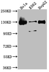 Western Blot; Positive WB detected in: Hela whole cell lysate, K562 whole cell lysate, HepG2 whole cell lysate; All lanes: Bub1 antibody at 1:1000; Secondary; Goat polyclonal to rabbit IgG at 1/50000 dilution; Predicted band size: 123, 116, 120 kDa; Observed band size: 130 kDa