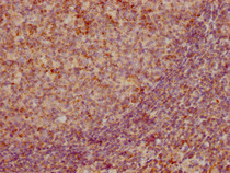 IHC image of RAC07208 diluted at 1:155 and staining in paraffin-embedded human tonsil tissue performed on a Leica BondTM system. After dewaxing and hydration, antigen retrieval was mediated by high pressure in a citrate buffer (pH 6.0). Section was blocked with 10% normal goat serum 30min at RT. Then primary antibody (1% BSA) was incubated at 4? overnight. The primary is detected by a biotinylated secondary antibody and visualized using an HRP conjugated SP system.