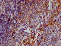IHC image of RAC07213 diluted at 1:100 and staining in paraffin-embedded human tonsil tissue performed on a Leica BondTM system. After dewaxing and hydration, antigen retrieval was mediated by high pressure in a citrate buffer (pH 6.0). Section was blocked with 10% normal goat serum 30min at RT. Then primary antibody (1% BSA) was incubated at 4? overnight. The primary is detected by a Goat anti-rabbit IgG polymer labeled by HRP and visualized using 0.05% DAB.