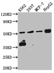 Western Blot; Positive WB detected in: K562 whole cell lysate, 293T whole cell lysate, MCF-7 whole cell lysate, HepG2 whole cell lysate; All lanes: Chk1 antibody at 1:1000; Secondary; Goat polyclonal to rabbit IgG at 1/50000 dilution; Predicted band size: 55, 44, 51 kDa; Observed band size: 55 kDa