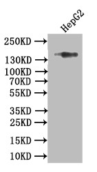 Western Blot; Positive WB detected in: HEPG2 whole cell lysate; All lanes: Collagen XVII antibody at 1:1000; Secondary; Goat polyclonal to rabbit IgG at 1/50000 dilution; Predicted band size: 150 kDa; Observed band size: 150 kDa