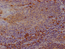 IHC image of RAC07270 diluted at 1:100 and staining in paraffin-embedded human tonsil tissue performed on a Leica BondTM system. After dewaxing and hydration, antigen retrieval was mediated by high pressure in a citrate buffer (pH 6.0). Section was blocked with 10% normal goat serum 30min at RT. Then primary antibody (1% BSA) was incubated at 4? overnight. The primary is detected by a Goat anti-rabbit IgG polymer labeled by HRP and visualized using 0.05% DAB.