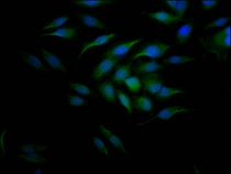 Immunofluorescence staining of Hela Cells with RAC07276 at 1:50, counter-stained with DAPI. The cells were fixed in 4% formaldehyde, permeated by 0.2% TritonX-100, and blocked in 10% normal Goat Serum. The cells were then incubated with the antibody overnight at 4?. Nuclear DNA was labeled in blue with DAPI. The secondary antibody was FITC-conjugated AffiniPure Goat Anti-Rabbit IgG (H+L).