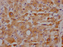 IHC image of RAC07279 diluted at 1:100 and staining in paraffin-embedded human liver tissue performed on a Leica BondTM system. After dewaxing and hydration, antigen retrieval was mediated by high pressure in a citrate buffer (pH 6.0). Section was blocked with 10% normal goat serum 30min at RT. Then primary antibody (1% BSA) was incubated at 4? overnight. The primary is detected by a Goat anti-rabbit IgG polymer labeled by HRP and visualized using 0.05% DAB.