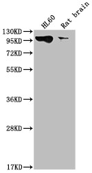 Western Blot; Positive WB detected in: HL60 whole cell lysate, Rat brain tissue; All lanes: DNM2 antibody at 1:2000; Secondary; Goat polyclonal to rabbit IgG at 1/50000 dilution; Predicted band size: 99, 98 kDa; Observed band size: 99 kDa