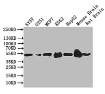 Western Blot; Positive WB detected in: SY5Y whole cell lysate,U251 whole cell lysate,MCF7 whole cell lysate,K562 whole cell lysate,Mouse Brain tissue lysate,Mouse Brain tissue lysate; All lanes: EGR2 antibody at 1:1000; Secondary; Goat polyclonal to rabbit IgG at 1/50000 dilution; Predicted band size: 50 kDa; Observed band size: 50 kDa