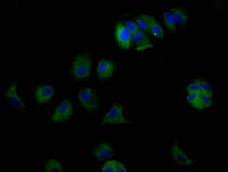 Immunofluorescence staining of MCF7 Cells with RAC07320 at 1:50, counter-stained with DAPI. The cells were fixed in 4% formaldehyde and blocked in 10% normal Goat Serum. The cells were then incubated with the antibody overnight at 4?. Nuclear DNA was labeled in blue with DAPI. The secondary antibody was FITC-conjugated AffiniPure Goat Anti-Rabbit IgG (H+L).