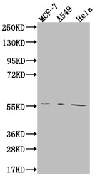 Western Blot; Positive WB detected in: MCF-7 whole cell lysate, A549 whole cell lysate, Hela whole cell lysate; All lanes: FADS1 antibody at 1:2000; Secondary; Goat polyclonal to rabbit IgG at 1/50000 dilution; Predicted band size: 52, 43 kDa; Observed band size: 55 kDa