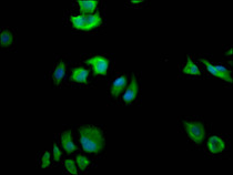 Immunofluorescence staining of Hela Cells with RAC07331 at 1:50, counter-stained with DAPI. The cells were fixed in 4% formaldehyde, permeated by 0.2% TritonX-100, and blocked in 10% normal Goat Serum. The cells were then incubated with the antibody overnight at 4?. Nuclear DNA was labeled in blue with DAPI. The secondary antibody was FITC-conjugated AffiniPure Goat Anti-Rabbit IgG (H+L).