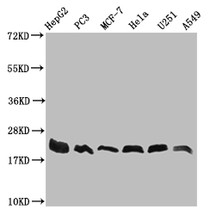 Western Blot; Positive WB detected in: HepG2 whole cell lysate, PC3 whole cell lysate, MCF-7 whole cell lysate, Hela whole cell lysate, U251 whole cell lysate, A549 whole cell lysate; All lanes: FIS1 antibody at 1:1000; Secondary; Goat polyclonal to rabbit IgG at 1/50000 dilution; Predicted band size: 17 kDa; Observed band size: 17-22 kDa