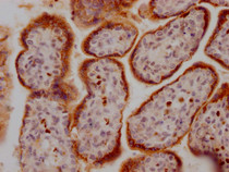 IHC image of RAC07361 diluted at 1:100 and staining in paraffin-embedded human placenta tissue performed on a Leica BondTM system. After dewaxing and hydration, antigen retrieval was mediated by high pressure in a citrate buffer (pH 6.0). Section was blocked with 10% normal goat serum 30min at RT. Then primary antibody (1% BSA) was incubated at 4? overnight. The primary is detected by a Goat anti-rabbit IgG polymer labeled by HRP and visualized using 0.05% DAB.