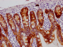 IHC image of RAC07367 diluted at 1:100 and staining in paraffin-embedded human small intestine tissue performed on a Leica BondTM system. After dewaxing and hydration, antigen retrieval was mediated by high pressure in a citrate buffer (pH 6.0). Section was blocked with 10% normal goat serum 30min at RT. Then primary antibody (1% BSA) was incubated at 4? overnight. The primary is detected by a Goat anti-rabbit IgG polymer labeled by HRP and visualized using 0.05% DAB.