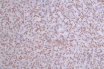 IHC image of RAC07386 diluted at 1:50 and staining in paraffin-embedded human pancreati tissue performed on a Leica BondTM system. After dewaxing and hydration, antigen retrieval was mediated by high pressure in a citrate buffer (pH 6.0). Section was blocked with 10% normal goat serum 30min at RT. Then primary antibody (1% BSA) was incubated at 4°C overnight. The primary is detected by a Goat anti-rabbit polymer IgG labeled by HRP and visualized using 0.27% DAB.