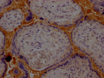 IHC image of RAC07388 diluted at 1:100 and staining in paraffin-embedded human placenta tissue performed on a Leica BondTM system. After dewaxing and hydration, antigen retrieval was mediated by high pressure in a citrate buffer (pH 6.0). Section was blocked with 10% normal goat serum 30min at RT. Then primary antibody (1% BSA) was incubated at 4? overnight. The primary is detected by a Goat anti-rabbit IgG polymer labeled by HRP and visualized using 0.05% DAB.