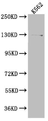 Western Blot; Positive WB detected in: K562 whole cell lysate; All lanes: HAUSP antibody at 1:1000; Secondary; Goat polyclonal to rabbit IgG at 1/50000 dilution; Predicted band size: 129, 127 kDa; Observed band size: 140 kDa