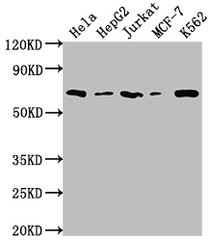 Western Blot; Positive WB detected in: Hela whole cell lysate, HepG2 whole cell lysate, Jurkat whole cell lysate, MCF-7 whole cell lysate, K562 whole cell lysate; All lanes: HDAC2 antibody at 1:2000; Secondary; Goat polyclonal to rabbit IgG at 1/50000 dilution; Predicted band size: 56, 52 kDa; Observed band size: 60 kDa