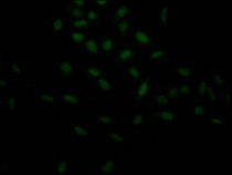 Immunofluorescence staining of Hela Cells with RAC07396 at 1:50, counter-stained with DAPI. The cells were fixed in 4% formaldehyde, permeated by 0.2% TritonX-100, and blocked in 10% normal Goat Serum. The cells were then incubated with the antibody overnight at 4?. Nuclear DNA was labeled in blue with DAPI. The secondary antibody was FITC-conjugated AffiniPure Goat Anti-Rabbit IgG (H+L).