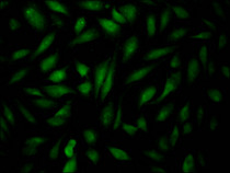 Immunofluorescence staining of Hela Cells with RAC07398 at 1:50, counter-stained with DAPI. The cells were fixed in 4% formaldehyde, permeated by 0.2% TritonX-100, and blocked in 10% normal Goat Serum. The cells were then incubated with the antibody overnight at 4?. Nuclear DNA was labeled in blue with DAPI. The secondary antibody was FITC-conjugated AffiniPure Goat Anti-Rabbit IgG (H+L).