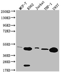 Western Blot; Positive WB detected in: MCF-7 whole cell lysate, K562 whole cell lysate, Jurkat whole cell lysate, THP-1 whole cell lysate, U937 whole cell lysate; All lanes: HMBS antibody at 1:2000; Secondary; Goat polyclonal to rabbit IgG at 1/50000 dilution; Predicted band size: 40, 38, 35, 34kDa; Observed band size: 36-55 kDa