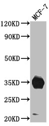 Western Blot; Positive WB detected in: MCF-7 whole cell lysate; All lanes: IGFBP2 antibody at 1:1000; Secondary; Goat polyclonal to rabbit IgG at 1/50000 dilution; Predicted band size: 35 kDa; Observed band size: 35 kDa