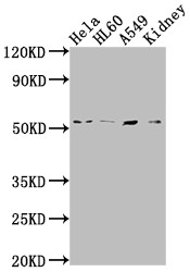 Western Blot; Positive WB detected in: Hela whole cell lysate, HL60 whole cell lysate, A549 whole cell lysate, Mouse kidney tissue; All lanes: ILK antibody at 1:2000; Secondary; Goat polyclonal to rabbit IgG at 1/50000 dilution; Predicted band size: 52, 45, 37 kDa; Observed band size: 51 kDa