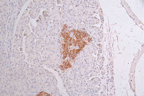 IHC image of RAC07471 diluted at 1:50 and staining in paraffin-embedded human pancreati tissue performed on a Leica BondTM system. After dewaxing and hydration, antigen retrieval was mediated by high pressure in a citrate buffer (pH 6.0). Section was blocked with 10% normal goat serum 30min at RT. Then primary antibody (1% BSA) was incubated at 4°C overnight. The primary is detected by a Goat anti-rabbit polymer IgG labeled by HRP and visualized using 0.34% DAB.