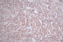 IHC image of RAC07482 diluted at 1:50 and staining in paraffin-embedded human tonsil tissue performed on a Leica BondTM system. After dewaxing and hydration, antigen retrieval was mediated by high pressure in a citrate buffer (pH 6.0). Section was blocked with 10% normal goat serum 30min at RT. Then primary antibody (1% BSA) was incubated at 4°C overnight. The primary is detected by a Goat anti-rabbit polymer IgG labeled by HRP and visualized using 0.52% DAB.