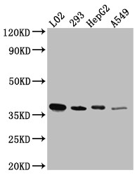 Western Blot; Positive WB detected in: L02 whole cell lysate, HEK293 whole cell lysate, HepG2 whole cell lysate, A549 whole cell lysate; All lanes: LRG1 antibody at 1:1000; Secondary; Goat polyclonal to rabbit IgG at 1/50000 dilution; Predicted band size: 39 kDa; Observed band size: 39 kDa