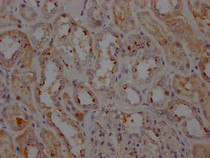 IHC image of RAC07491 diluted at 1:100 and staining in paraffin-embedded human kidney tissue performed on a Leica BondTM system. After dewaxing and hydration, antigen retrieval was mediated by high pressure in a citrate buffer (pH 6.0). Section was blocked with 10% normal goat serum 30min at RT. Then primary antibody (1% BSA) was incubated at 4? overnight. The primary is detected by a Goat anti-rabbit IgG polymer labeled by HRP and visualized using 0.05% DAB.