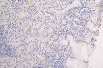 IHC image of RAC07502 diluted at 1:50 and staining in paraffin-embedded human brain tissue performed on a Leica BondTM system. After dewaxing and hydration, antigen retrieval was mediated by high pressure in a citrate buffer (pH 6.0). Section was blocked with 10% normal goat serum 30min at RT. Then primary antibody (1% BSA) was incubated at 4°C overnight. The primary is detected by a Goat anti-rabbit polymer IgG labeled by HRP and visualized using 0.10% DAB.