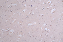 IHC image of RAC07504 diluted at 1:100 and staining in paraffin-embedded human brain tissue performed on a Leica BondTM system. After dewaxing and hydration, antigen retrieval was mediated by high pressure in a citrate buffer (pH 6.0). Section was blocked with 10% normal goat serum 30min at RT. Then primary antibody (1% BSA) was incubated at 4°C overnight. The primary is detected by a Goat anti-rabbit polymer IgG labeled by HRP and visualized using 0.12% DAB.