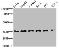 Western Blot; Positive WB detected in: Hela whole cell lysate, HepG2 whole cell lysate, Jurkat whole cell lysate, Raji whole cell lysate, PC3 whole cell lysate, THP-1 whole cell lysate; All lanes: NFKBIA antibody at 0.79ug/ml; Secondary; Goat polyclonal to rabbit IgG at 1/50000 dilution; Predicted band size: 36 KDa; Observed band size: 36 KDa