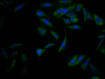 Immunofluorescence staining of Hela Cells with RAC07553 at 1:50, counter-stained with DAPI. The cells were fixed in 4% formaldehyde, permeated by 0.2% TritonX-100, and blocked in 10% normal Goat Serum. The cells were then incubated with the antibody overnight at 4?. Nuclear DNA was labeled in blue with DAPI. The secondary antibody was FITC-conjugated AffiniPure Goat Anti-Rabbit IgG (H+L).