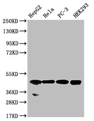 Western Blot; Positive WB detected in: HepG2 whole cell lysate, Hela whole cell lysate, PC-3 whole cell lysate, HEK293 whole cell lysate; All lanes: NSDHL antibody at 1:1000; Secondary; Goat polyclonal to rabbit IgG at 1/50000 dilution; Predicted band size: 42 kDa; Observed band size: 42 kDa