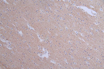 IHC image of RAC07578 diluted at 1:50 and staining in paraffin-embedded human brain tissue performed on a Leica BondTM system. After dewaxing and hydration, antigen retrieval was mediated by high pressure in a citrate buffer (pH 6.0). Section was blocked with 10% normal goat serum 30min at RT. Then primary antibody (1% BSA) was incubated at 4°C overnight. The primary is detected by a Goat anti-rabbit polymer IgG labeled by HRP and visualized using 0.1:50% DAB.