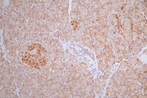 IHC image of RAC07582 diluted at 1:100 and staining in paraffin-embedded human pancreati tissue performed on a Leica BondTM system. After dewaxing and hydration, antigen retrieval was mediated by high pressure in a citrate buffer (pH 6.0). Section was blocked with 10% normal goat serum 30min at RT. Then primary antibody (1% BSA) was incubated at 4°C overnight. The primary is detected by a Goat anti-rabbit polymer IgG labeled by HRP and visualized using 0.55% DAB.