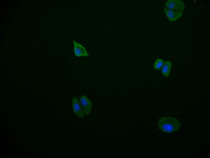 Immunofluorescence staining of HepG2 cell at 1:50, counter-stained with DAPI. The cells were fixed in 4% formaldehyde and blocked in 10% normal Goat Serum. The cells were then incubated with the antibody overnight at 4°C. The secondary antibody was Alexa Fluor 569-congugated AffiniPure Goat Anti-Rabbit IgG(H+L).