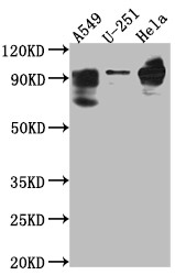 Western Blot; Positive WB detected in: THP-1 whole cell lysate; All lanes: PDE4D antibody at 1:1000; Secondary; Goat polyclonal to rabbit IgG at 1/50000 dilution; Predicted band size: 92, 77, 69, 67, 58, 85, 24, 60, 78, 77, 85, 25 kDa; Observed band size: 92 kDa