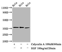 Western Blot; Positive WB detected in Hela whole cell lysate(treated with Calyculin A or EGF) ; All lanes Phospho-EIF2S1 antibody at 1.48ug/ml; Secondary; Goat polyclonal to rabbit IgG at 1/50000 dilution; Predicted band size: 36 KDa; Observed band size: 36 KDa