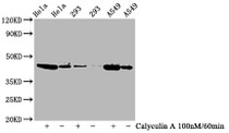 Western Blot; Positive WB detected in Hela whole cell lysate,293 whole cell lysate,A549 whole cell lysate(treated with Calyculin A or not); All lanes Phospho-GSK3B antibody at 0.77ug/ml; Secondary; Goat polyclonal to rabbit IgG at 1/50000 dilution; Predicted band size: 46 KDa; Observed band size: 46 KDa