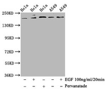 Western Blot; Positive WB detected in Hela whole cell lysate,A549 whole cell lysate(treated with EGF or Pervanadate); All lanes Phospho-PDGFRB antibody at 1.14ug/ml; Secondary; Goat polyclonal to rabbit IgG at 1/50000 dilution; Predicted band size: 190 KDa; Observed band size: 190 KDa