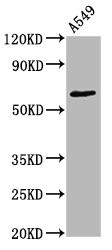 Western Blot; Positive WB detected in A549 whole cell lysate; All lanes Phospho-PRKCZ antibody at 1.55ug/ml; Secondary; Goat polyclonal to rabbit IgG at 1/50000 dilution; Predicted band size: 68 KDa; Observed band size: 68 KDa