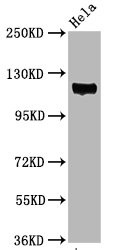 Western Blot; Positive WB detected in Hela whole cell lysate; All lanes Phospho-PTK2 antibody at 3.05ug/ml; Secondary; Goat polyclonal to rabbit IgG at 1/50000 dilution; Predicted band size: 119 KDa; Observed band size: 119 KDa
