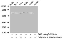 Western Blot; Positive WB detected in Hela whole cell lysate,A549 whole cell lysate,HepG2 whole cell lysate(treated with Calyculin A or EGF); All lanes Phospho-PXN antibody at 1.43ug/ml; Secondary; Goat polyclonal to rabbit IgG at 1/50000 dilution; Predicted band size: 68 KDa; Observed band size: 68 KDa
