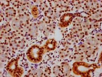IHC image of RAC07654 diluted at 1:100 and staining in paraffin-embedded human pancreatic tissue performed on a Leica BondTM system. After dewaxing and hydration, antigen retrieval was mediated by high pressure in a citrate buffer (pH 6.0). Section was blocked with 10% normal goat serum 30min at RT. Then primary antibody (1% BSA) was incubated at 4? overnight. The primary is detected by a biotinylated secondary antibody and visualized using an HRP conjugated SP system.