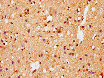 IHC image of RAC07656 diluted at 1:100 and staining in paraffin-embedded human brain tissue performed on a Leica BondTM system. After dewaxing and hydration, antigen retrieval was mediated by high pressure in a citrate buffer (pH 6.0). Section was blocked with 10% normal goat serum 30min at RT. Then primary antibody (1% BSA) was incubated at 4? overnight. The primary is detected by a biotinylated secondary antibody and visualized using an HRP conjugated SP system.