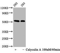 Western Blot; Positive WB detected in: 293 whole cell lysate(treated with Calyculin A or not); All lanes: Phospho-TP53 antibody at 0.64ug/ml; Secondary; Goat polyclonal to rabbit IgG at 1/50000 dilution; Predicted band size: 53 KDa; Observed band size: 53 KDa