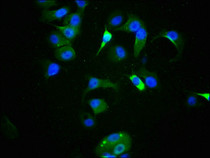 Immunofluorescence staining of MCF-7 cells with RAC07662 at 1:100,counter-stained with DAPI. The cells were fixed in 4% formaldehyde, permeabilized using 0.2% Triton X-100 and blocked in 10% normal Goat Serum. The cells were then incubated with the antibody overnight at 4?. The secondary antibody was Alexa Fluor 488-congugated AffiniPure Goat Anti-Rabbit IgG (H+L).